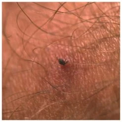 Tire-tique Lifesystems Tick Card White -Magasin De Matériel De Camping En Plein Air 5caa9b000328b9fce2cba62ee690e4a28e83c865 E23LIFSBIV381147 LIFS0202195 901